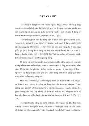 Cải tiến kỹ thuật Nagata trong tạo hình tai nhỏ