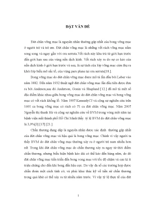 Nghiên cứu bong võng mạc do đứt chân võng mạc ở người trẻ